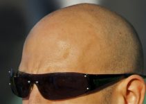 ¡Cómo Proteger una Cabeza Calva del Sol! ¡Cómo Proteger una Cabeza Calva del Sol!