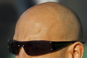 ¡Cómo Proteger una Cabeza Calva del Sol!