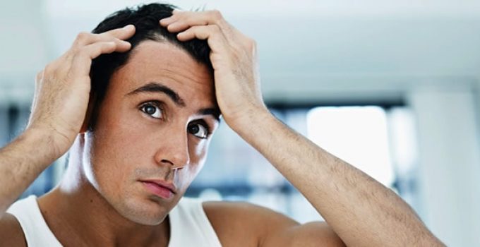 ¿Perder El Pelo Te Está Generando Traumas Y Complejos?