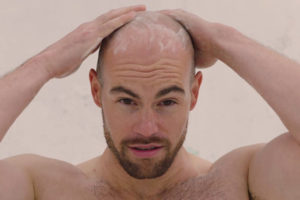 ¿Deben las Personas Calvas Usar Shampoo?