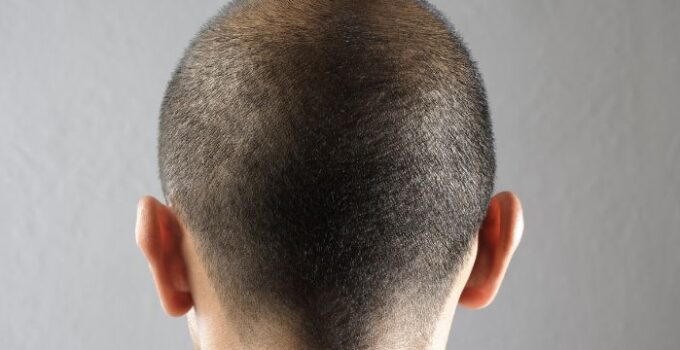 ¿Con Qué Frecuencia Debes Afeitarte la Cabeza?