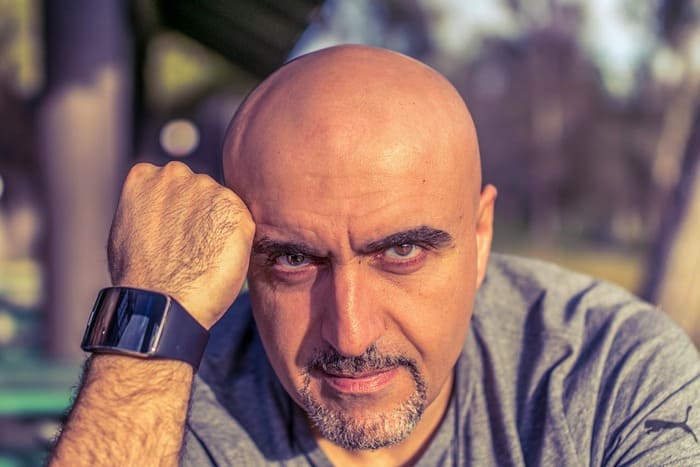 Cuantos hombres calvos hay